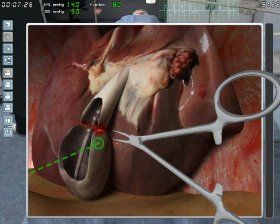 Surgery Simulator 2011 Pc Games